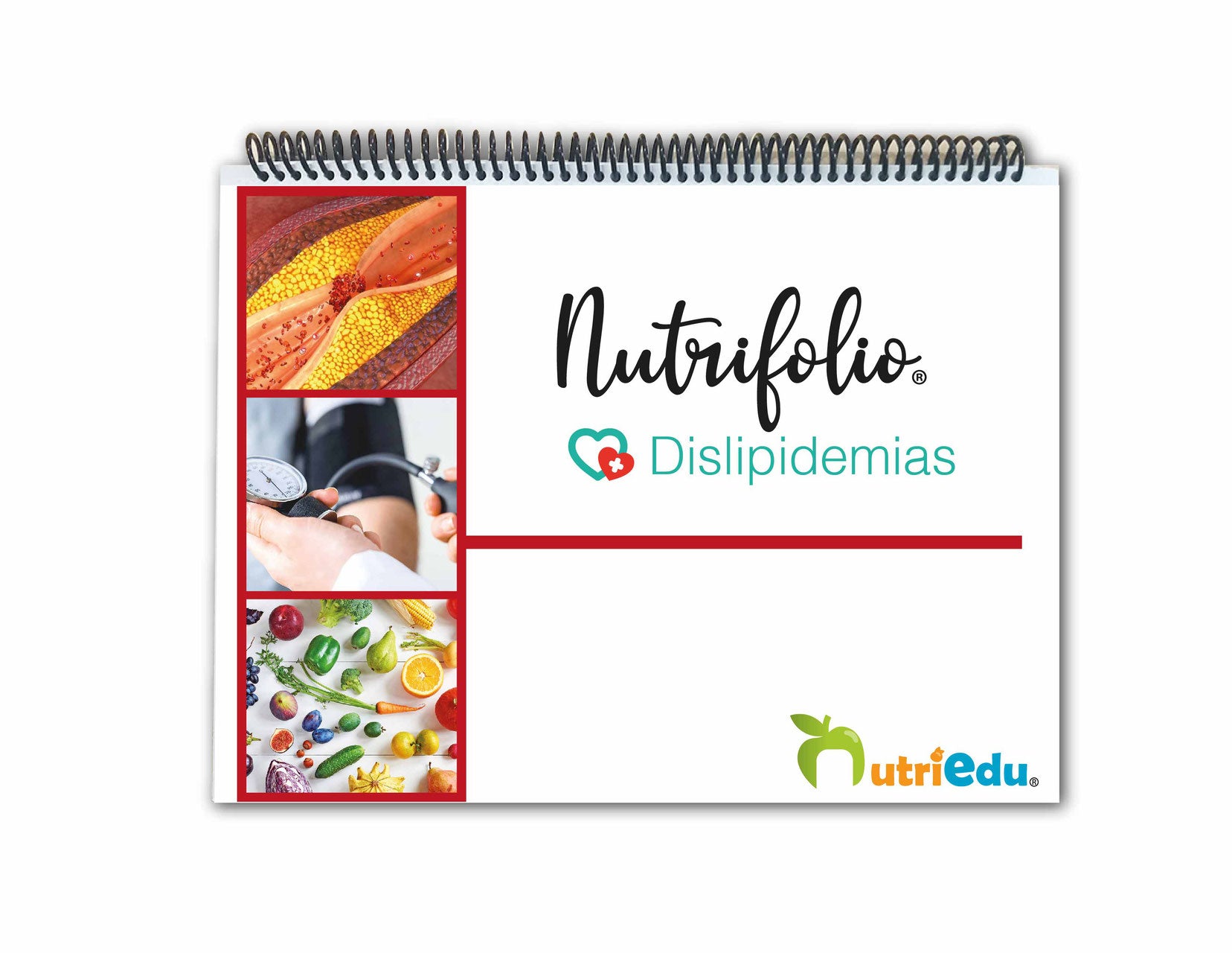 Nutrifolio Dislipidemias